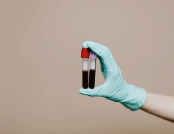 Diagnostic blood tests